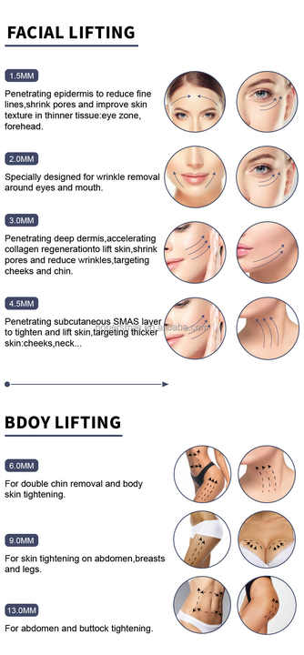 Vault of Wellness 7D Ultra Lift – Professional HIFU Skin Tightening & Lifting Device