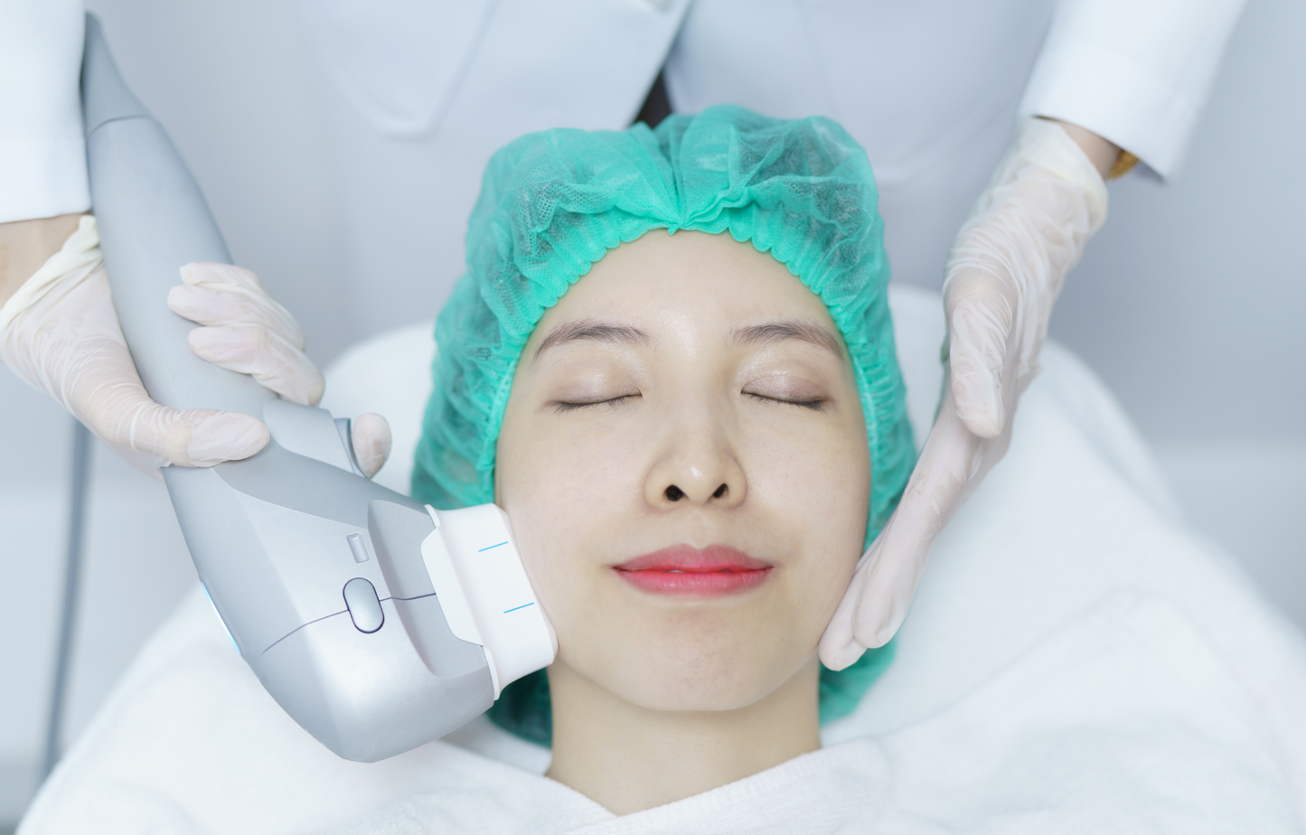 Vault of Wellness 7D Ultra Lift – Professional HIFU Skin Tightening & Lifting Device