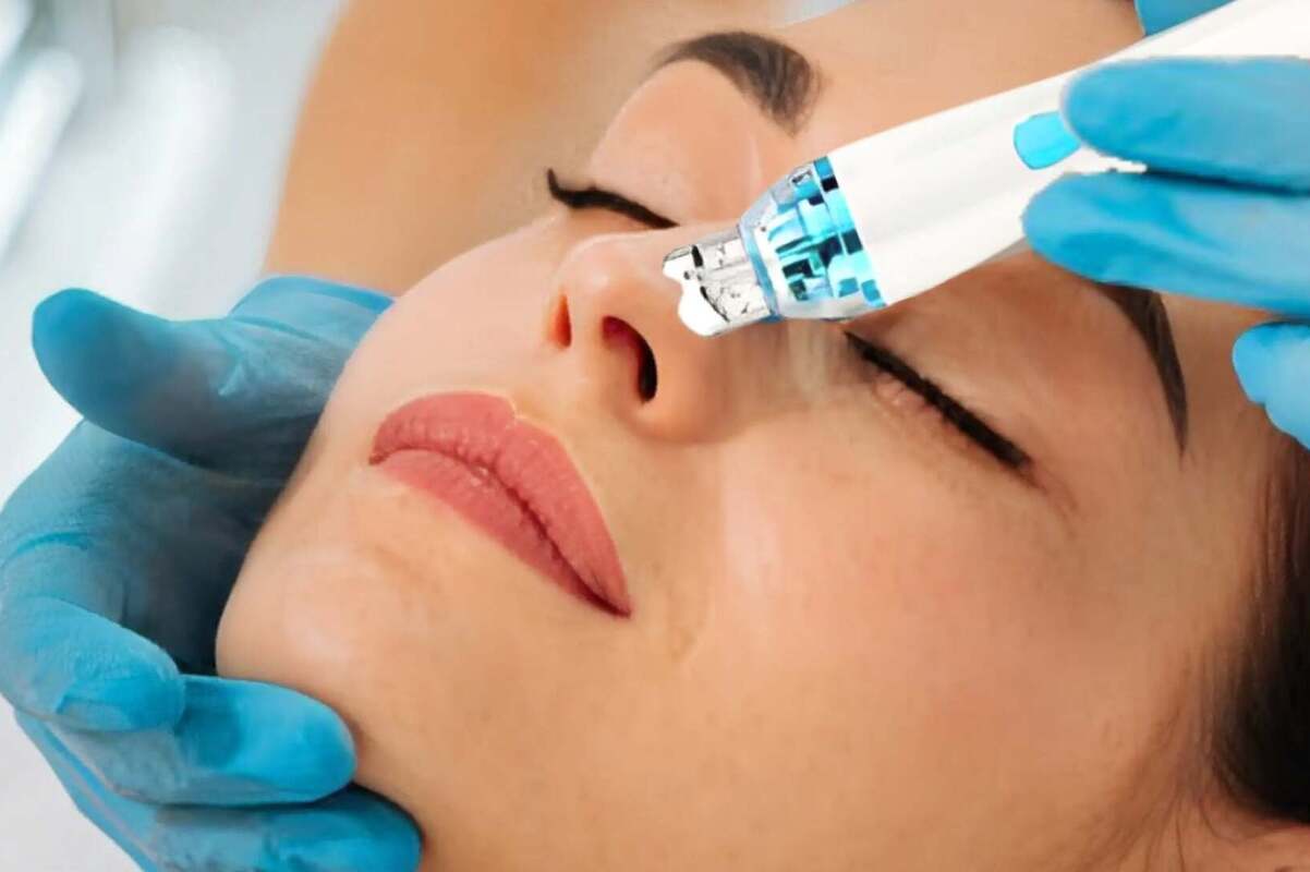 Vault of Wellness  Portable 3 In 1 Diamond HydraDermabrasion Machine